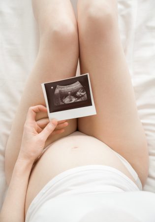 Close-up of torso of young pregnant model looking at ultrasonography image of her baby. Future mom on her second trimester holding ultrasound scan of her child. Maternity concept